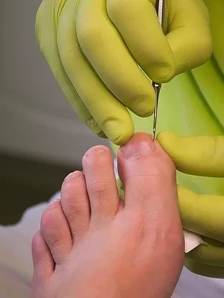 podología general en Málaga